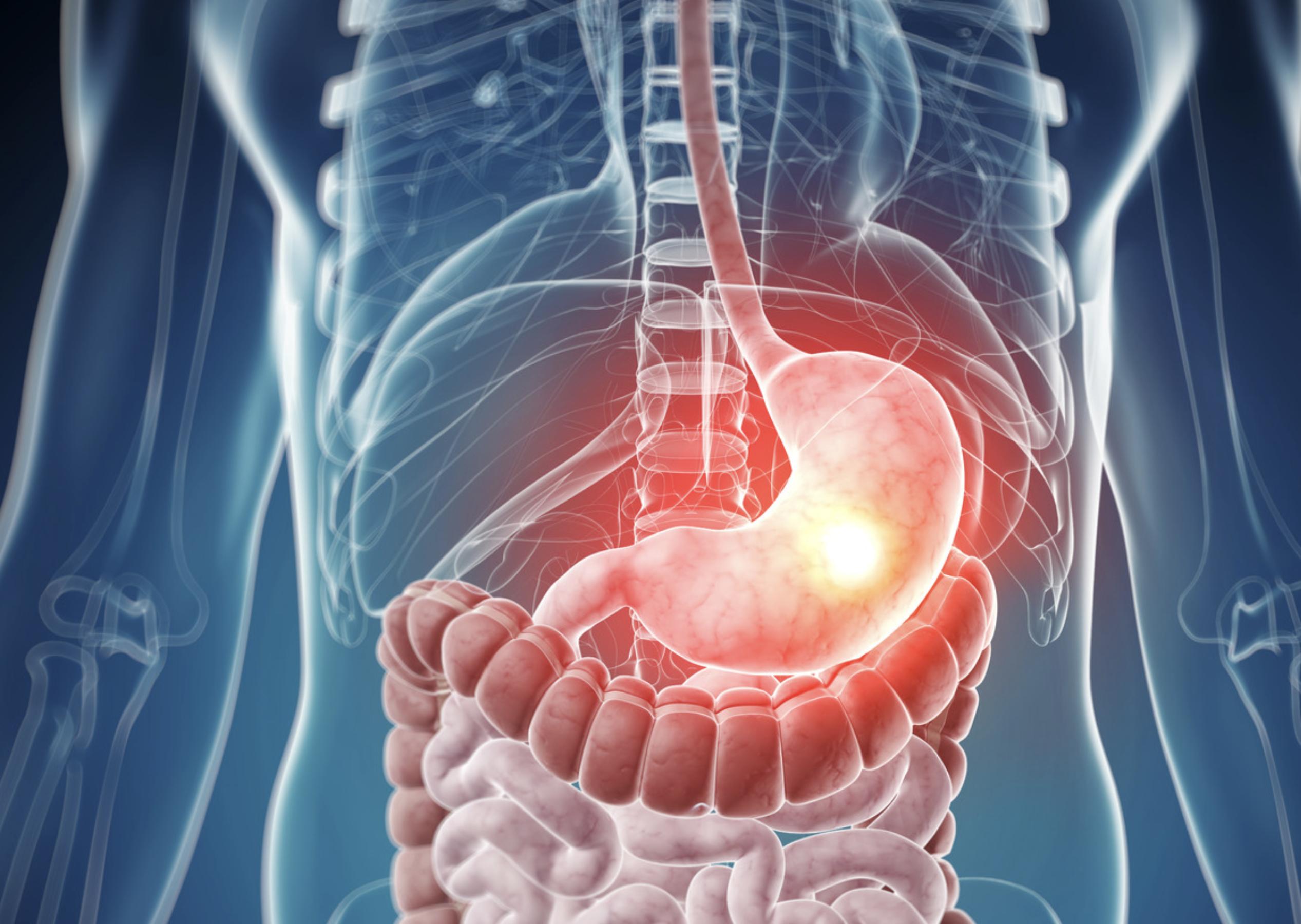 Benarkah Penyakit Lambung bisa Sebabkan Kematian?